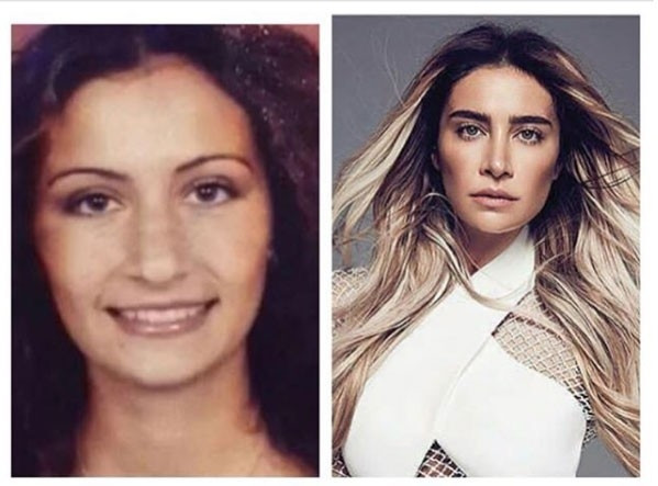 Sıla'nın estetiksiz hali görenin ağzını açık bıraktı! - Sayfa 7