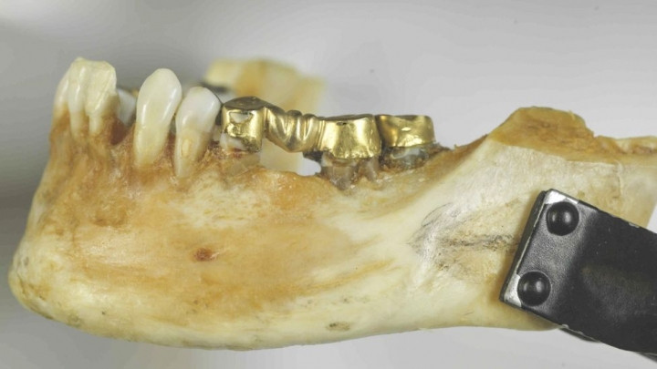 46 yıldır çözülemeyen bir ölüm hikayesi! - Sayfa 28