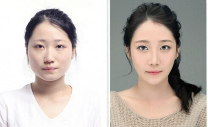 Korelilerin estetik çılgınlığı sonucu büyük değişimleri! - Sayfa 17