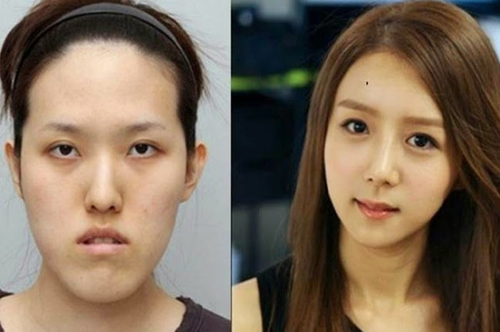 Korelilerin estetik çılgınlığı sonucu büyük değişimleri! - Sayfa 21