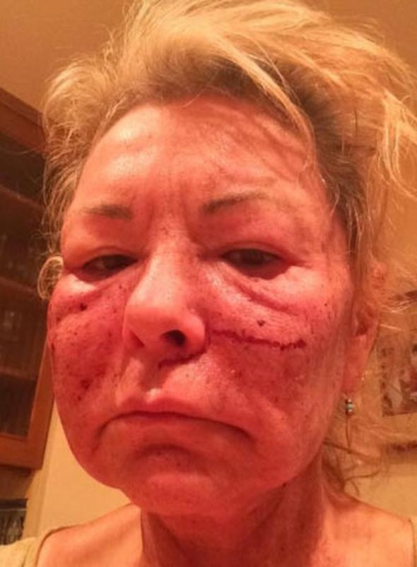 Kim Kardashian'ın öncülük ettiği bu gençlik formülü göz korkutuyor! - Sayfa 13