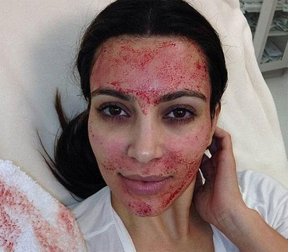 Kim Kardashian'ın öncülük ettiği bu gençlik formülü göz korkutuyor! - Sayfa 5