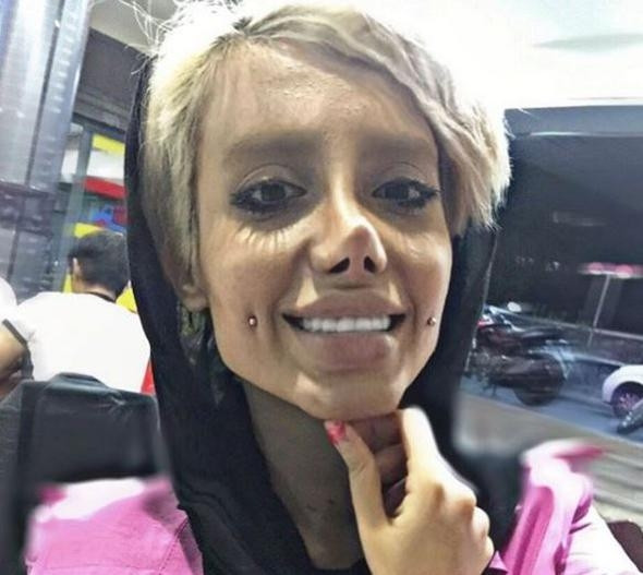 Angelina Jolie'ye benzemek için estetik oldu, insanlıktan çıktı! - Sayfa 10