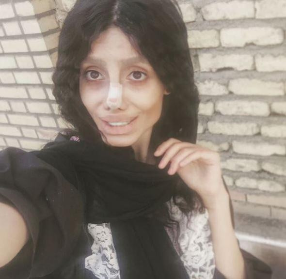 Angelina Jolie'ye benzemek için estetik oldu, insanlıktan çıktı! - Sayfa 18