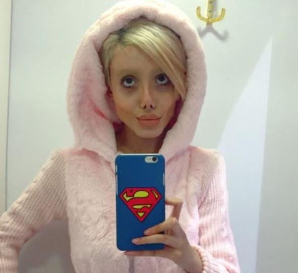 Angelina Jolie'ye benzemek için estetik oldu, insanlıktan çıktı! - Sayfa 11