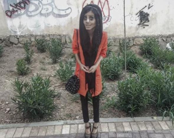 Angelina Jolie'ye benzemek için estetik oldu, insanlıktan çıktı! - Sayfa 15