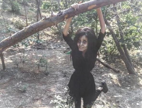 Angelina Jolie'ye benzemek için estetik oldu, insanlıktan çıktı! - Sayfa 20