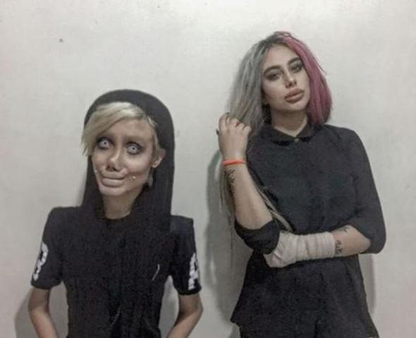 Angelina Jolie'ye benzemek için estetik oldu, insanlıktan çıktı! - Sayfa 8