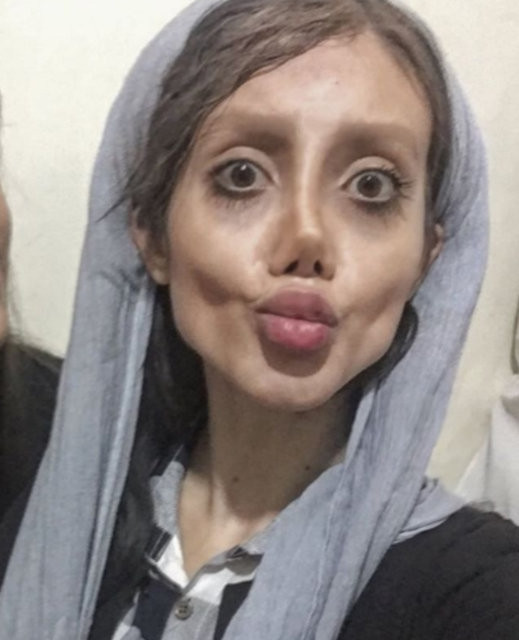 Angelina Jolie'ye benzemek için estetik oldu, insanlıktan çıktı! - Sayfa 22