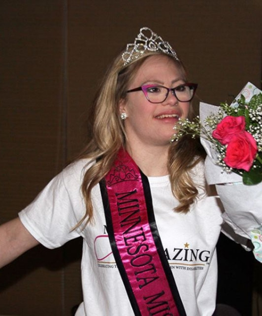 Güzellik yarışmasında dünyada bir ilki başardı! - Sayfa 17