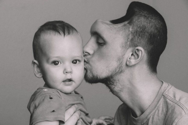 Enerji içeceği yüzünden bu hale geldi! Eşi hiç yalnız bırakmadı - Sayfa 9