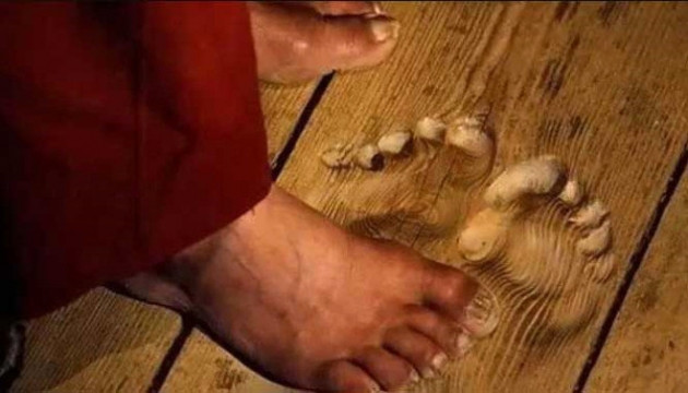 Tam 31 parmakla dünyaya geldi! - Sayfa 13