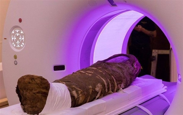 1900 yıllık mumyanın büyük sırrı! - Sayfa 6