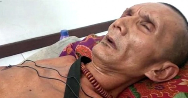 Geçirdiği kaza sonrası vücudu taşlaştı! - Sayfa 9