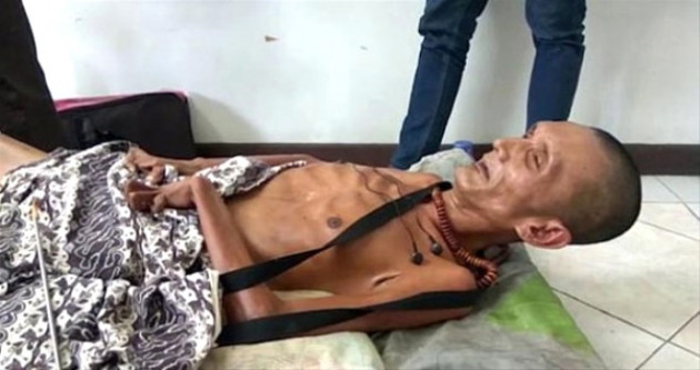 Geçirdiği kaza sonrası vücudu taşlaştı! - Sayfa 8