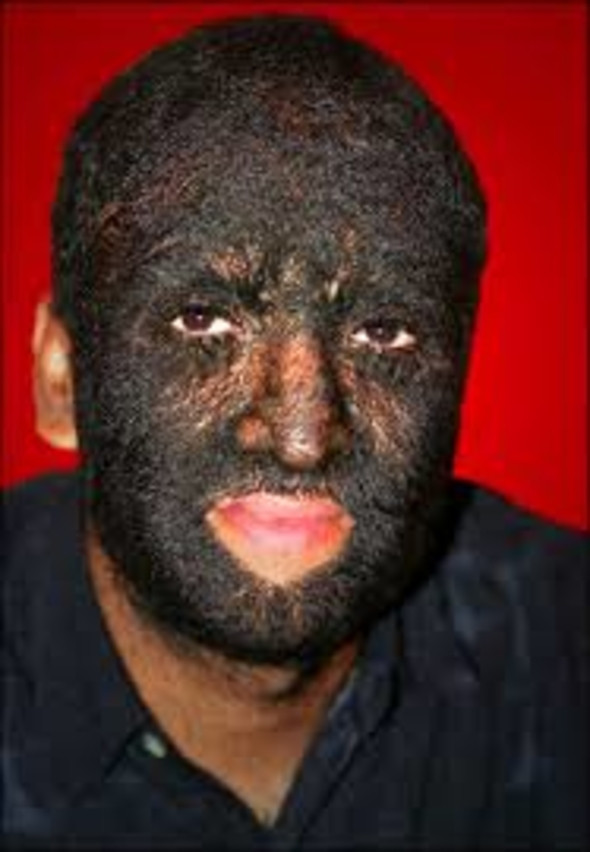 Dünyanın en kıllı adamı mutluluğu buldu! - Sayfa 12