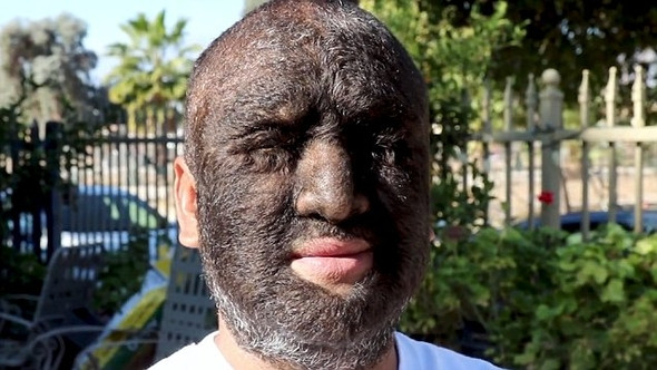 Dünyanın en kıllı adamı mutluluğu buldu! - Sayfa 9