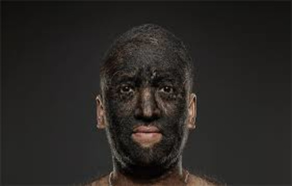 Dünyanın en kıllı adamı mutluluğu buldu! - Sayfa 15