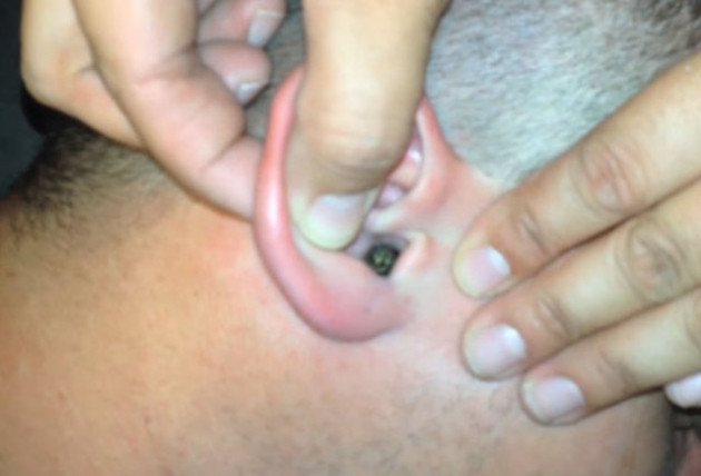 Kulağından çıkanlara kimse inanamadı! - Sayfa 5