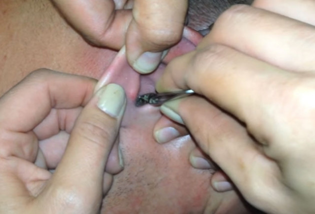 Kulağından çıkanlara kimse inanamadı! - Sayfa 9