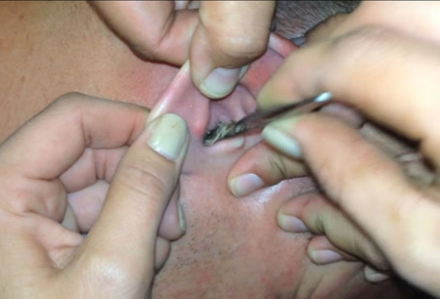 Kulağından çıkanlara kimse inanamadı! - Sayfa 11