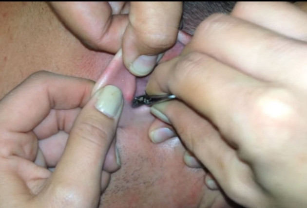 Kulağından çıkanlara kimse inanamadı! - Sayfa 8