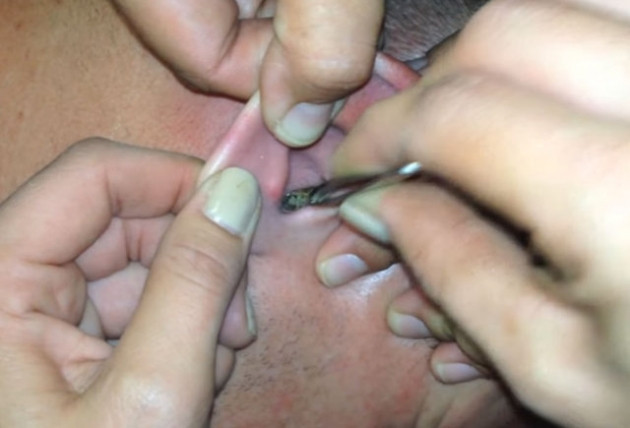 Kulağından çıkanlara kimse inanamadı! - Sayfa 12