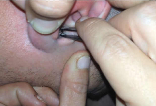 Kulağından çıkanlara kimse inanamadı! - Sayfa 7