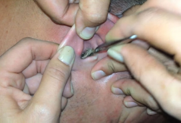 Kulağından çıkanlara kimse inanamadı! - Sayfa 10