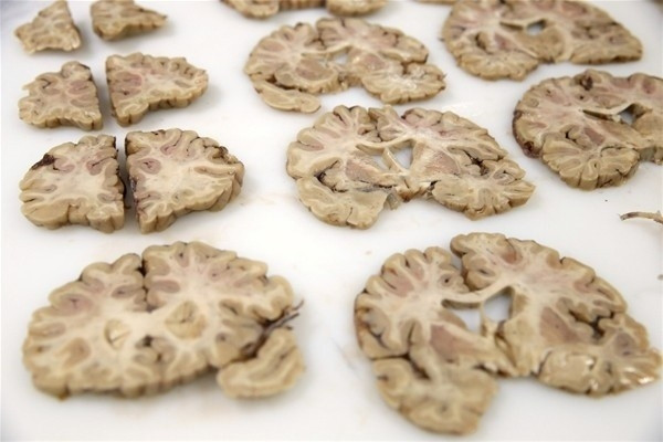 Beynimizin içi bakın nasıl görünüyor! - Sayfa 16