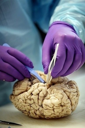 Beynimizin içi bakın nasıl görünüyor! - Sayfa 7