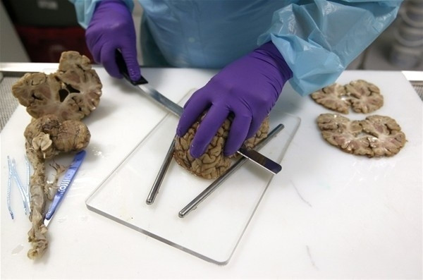 Beynimizin içi bakın nasıl görünüyor! - Sayfa 13