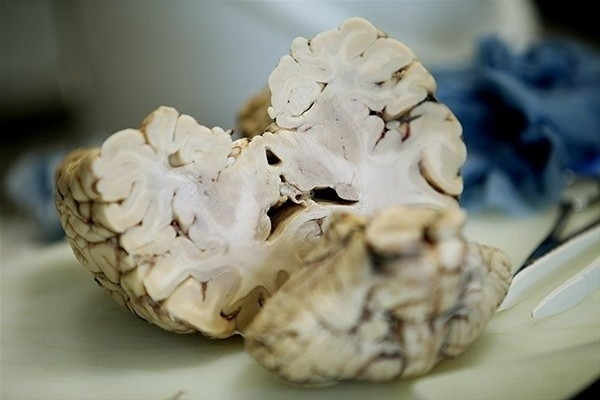 Beynimizin içi bakın nasıl görünüyor! - Sayfa 15