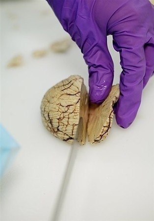 Beynimizin içi bakın nasıl görünüyor! - Sayfa 8