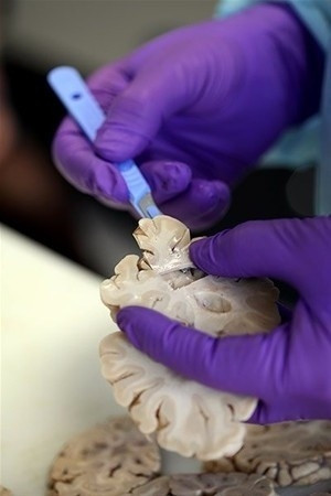 Beynimizin içi bakın nasıl görünüyor! - Sayfa 9