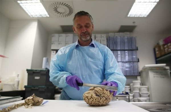 Beynimizin içi bakın nasıl görünüyor! - Sayfa 12