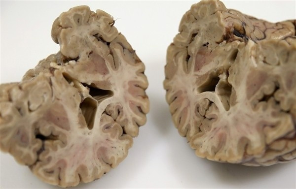 Beynimizin içi bakın nasıl görünüyor! - Sayfa 18