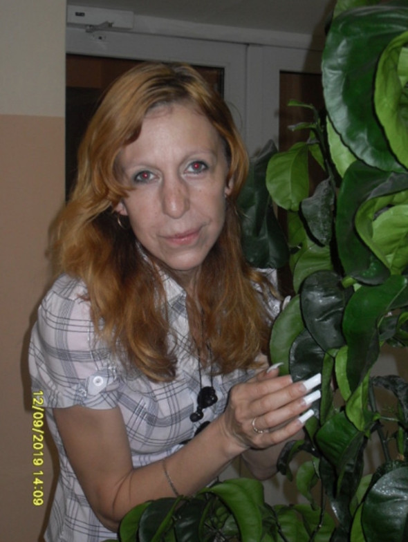 Ailesi hastalığı nedeniyle terk etmişti! İşte son hali - Sayfa 9