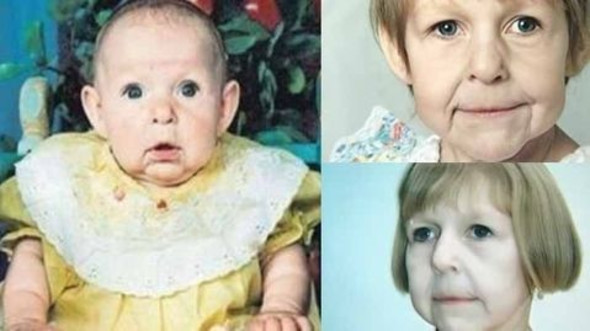 Ailesi hastalığı nedeniyle terk etmişti! İşte son hali - Sayfa 14